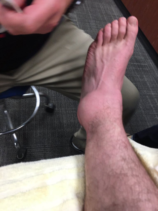 Illustration for article titled Dude, Jason Kipnis, Are You Sure You Can Play On Your Sprained Ankle?